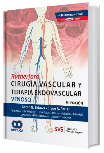 Rutherford. Cirugía vascular y Terapia Endovascular. Venoso.  9 edición