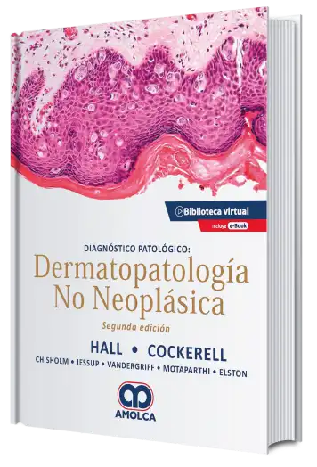 Diagnóstico Patológico: Dermatopatología no Neoplásica. 2 edición