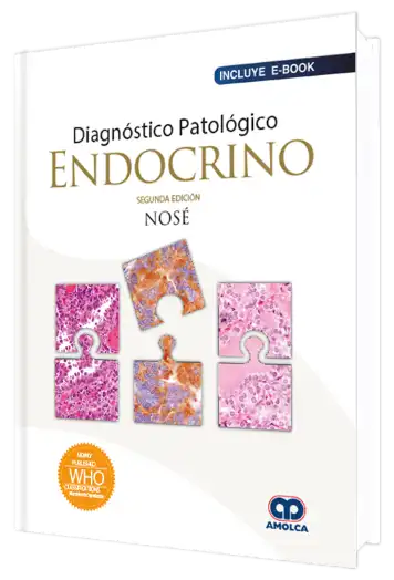 Diagnóstico Patológico Endocrino 2 edición