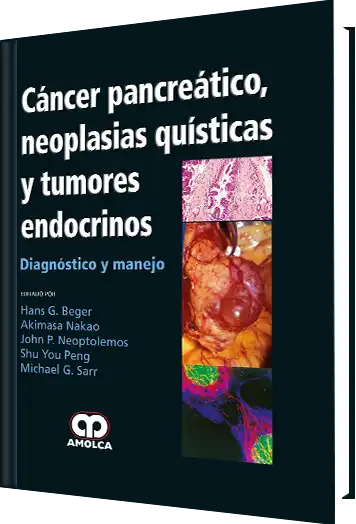 Cáncer Pancreático, Neoplasias Quísticas y Tumores Endocrinos
