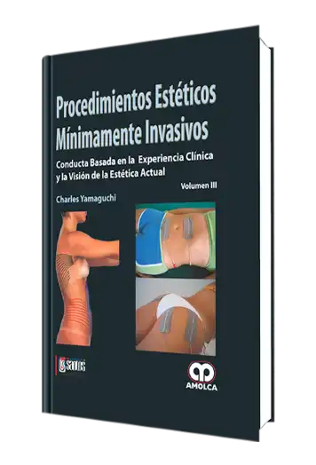 Procedimientos Estéticos Mínimamente Invasivos Volumen 3