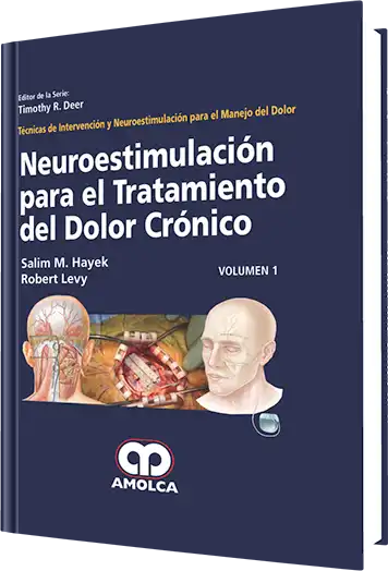 Neuroestimulación para el Tratamiento del Dolor Crónico Volumen 1