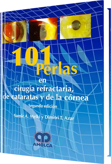 101 Perlas en Cirugía Refractaria, de Cataratas y de la Córnea. 2 edición