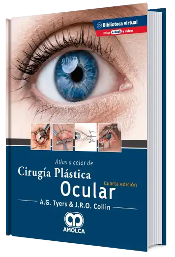 Atlas a Color de Cirugía Plástica Ocular. 4 edición