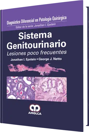 Diagnóstico Diferencial en Patología Quirúrgica Sistema Genitourinario