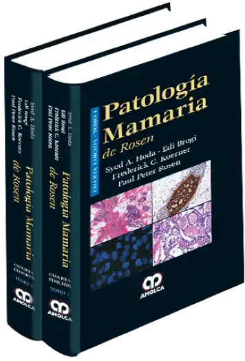 Patología Mamaria de Rosen. 4 Edición