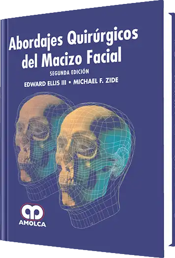 Abordajes Quirúrgicos del Macizo Facial 2 edición