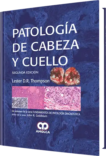 Patología de Cabeza y Cuello. 2 Edición
