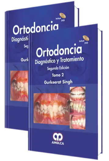 Ortodoncia. Diagnóstico y Tratamiento 2 edición