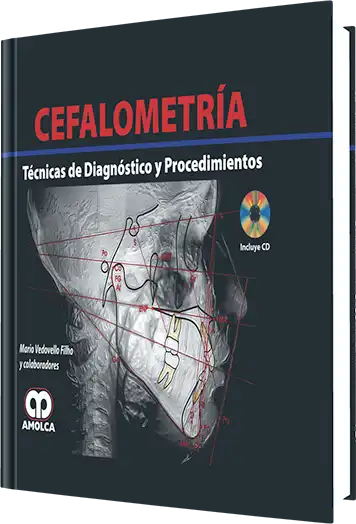 Cefalometría. Técnicas de Diagnóstico y Procedimientos