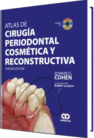 Atlas de Cirugía Periodontal Cosmética y Reconstructiva. 3 edición