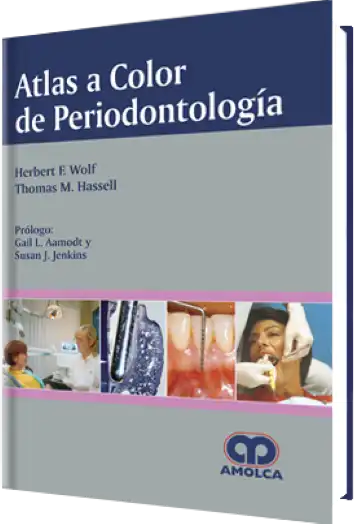 Atlas a Color de Periodontología
