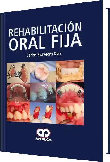 Rehabilitación Oral Fija