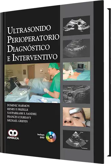 Ultrasonido Perioperatorio Diagnóstico e Interventivo