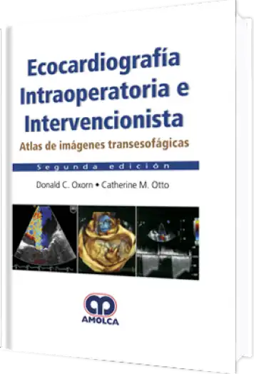 Ecocardiografía Intraoperatoria e Intervencionista 2 edición
