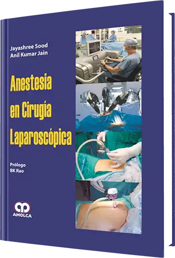 Anestesia en Cirugía Laparoscópica