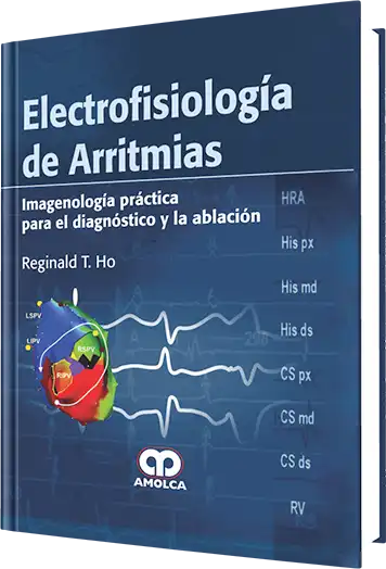 Electrofisiología de Arritmias