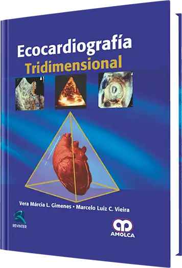 Ecocardiografía Tridimensional