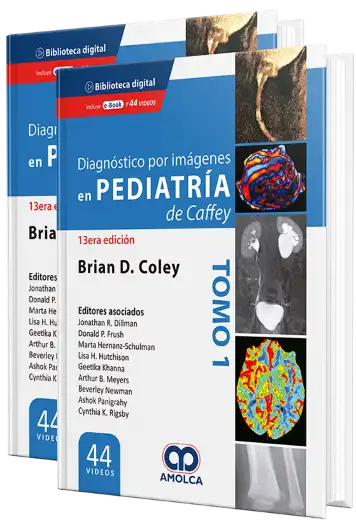 Diagnóstico por Imágenes en Pediatría de Caffey. 13 Edición