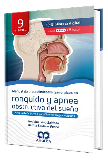 Manual de Procedimientos quirúrgicos en Ronquido y Apnea obstructiva del sueño