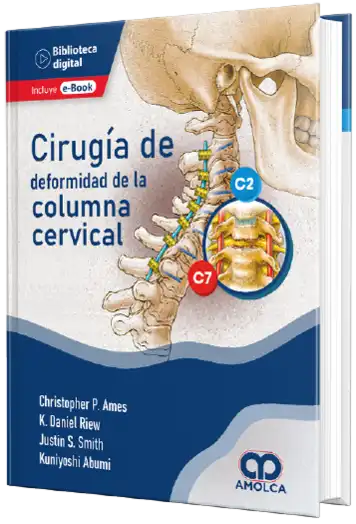 Cirugía de deformidad de la Columna Cervical