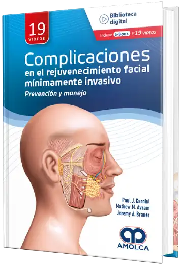 Complicaciones en el rejuvenecimiento facial mínimamente invasivo  - Prevención y manejo